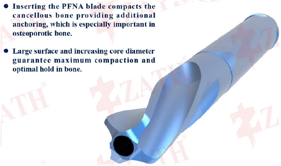 ZAFIN Femur Intramedullary Nail Components