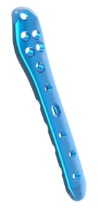 Proximal Femur Locking Plate V