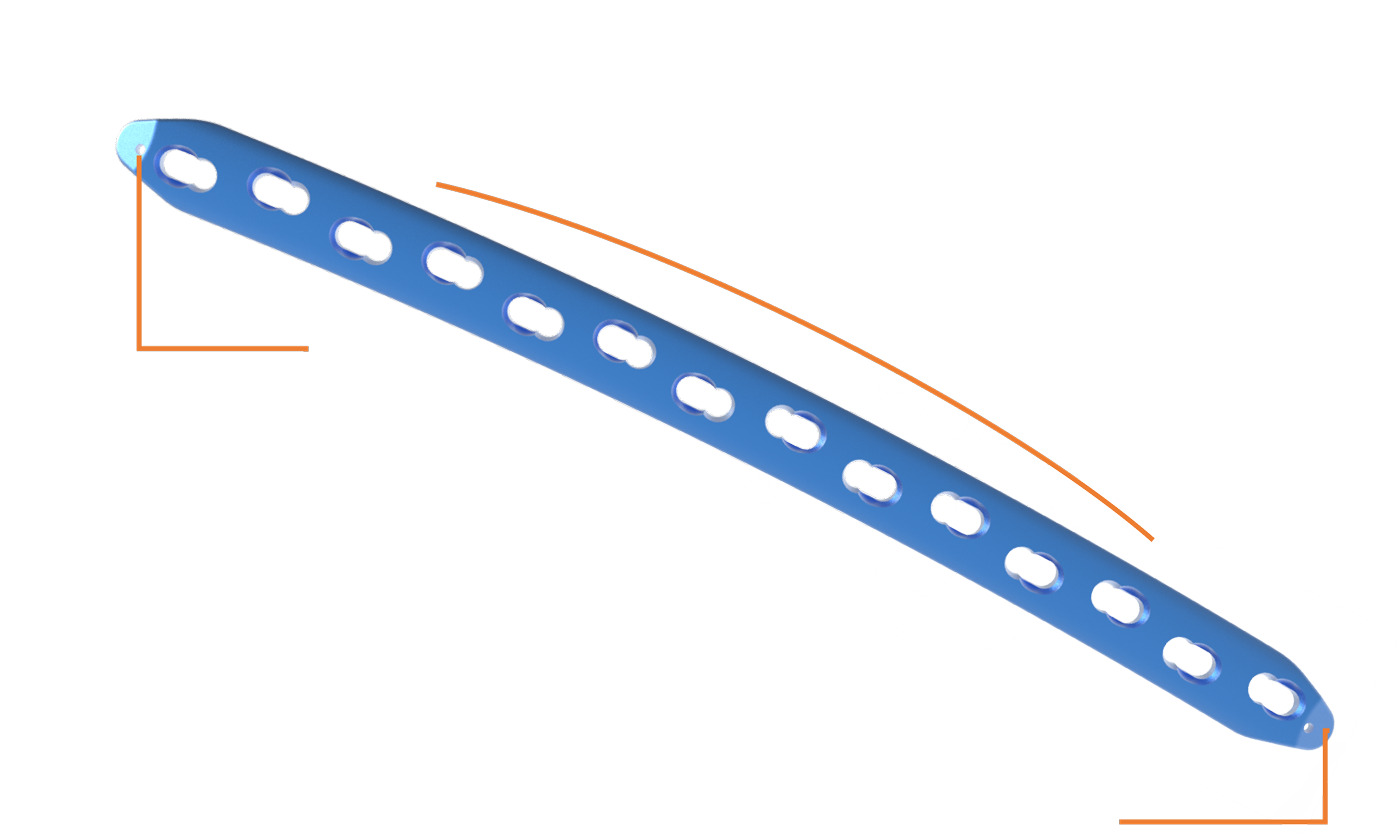 2.0mm K-wire holes aid plate positioning