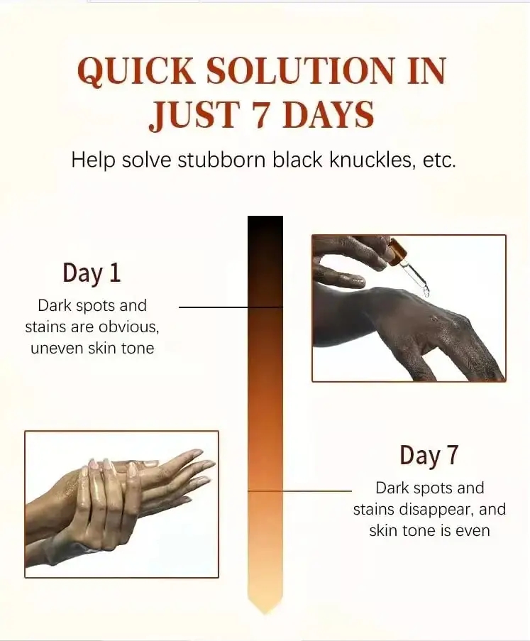 Private Label Dark Knuckle Whitening Serum Oem, Bulk