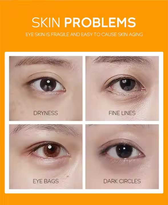 Private Label Whitening Nourishing Under Eye Cream Oem, Odm