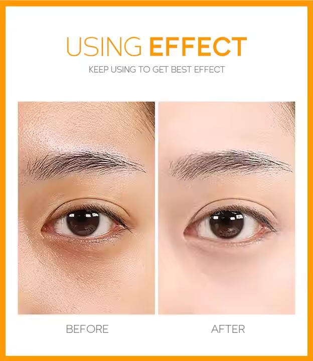 Private Label Whitening Nourishing Under Eye Cream Oem, Odm