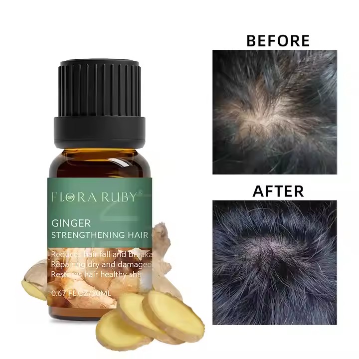 Private Label Wholesale Essential Oil for Hair Growth Factory, Odm