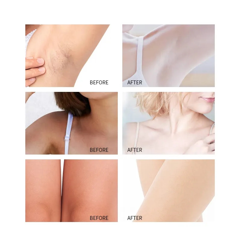 Underarm Cream Product Display 4