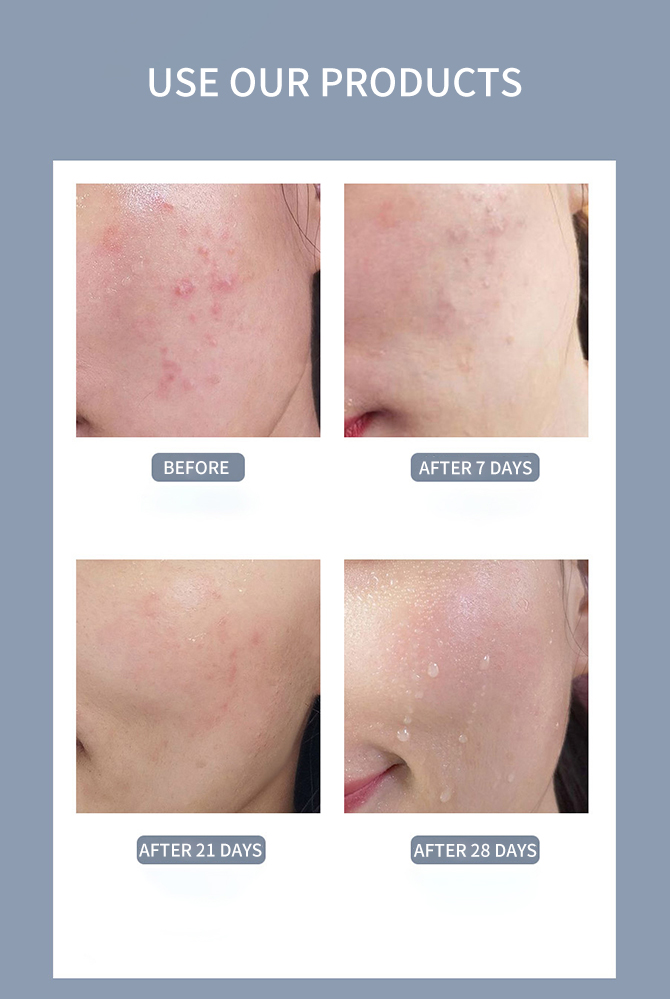 Hydrating Skin Formula