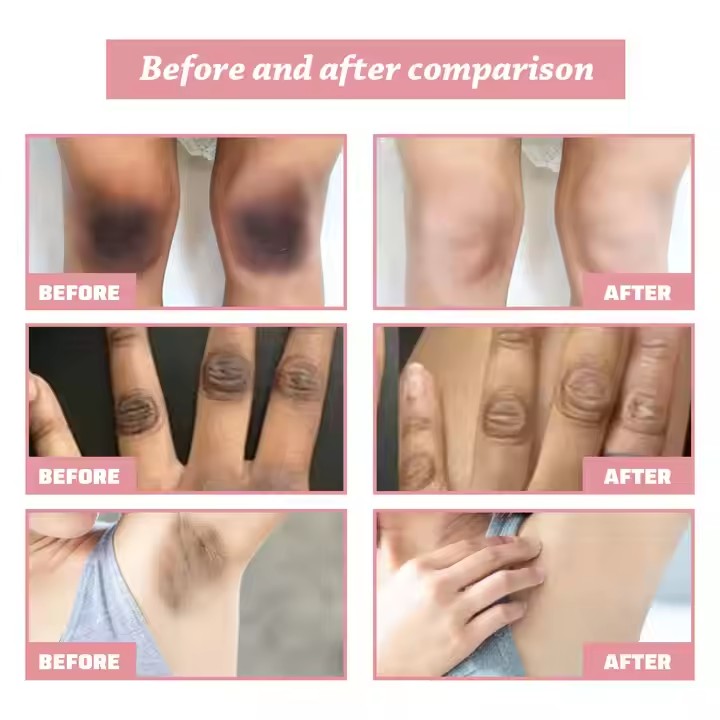 Private Label Lotion Body Arbutin Black Skin Care Supplier, Bulk