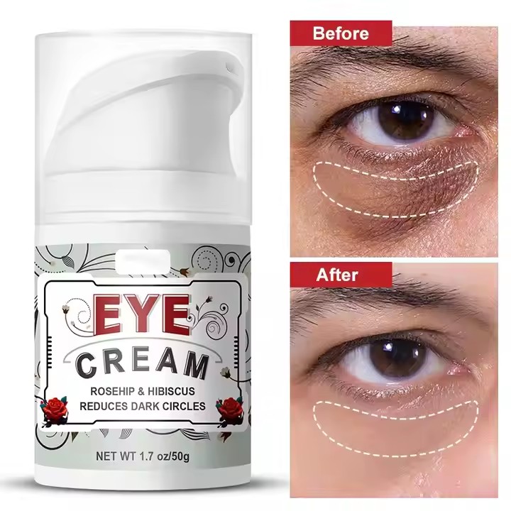 Private Label Dark Circles Under Eye Cream Moisturizer Supplier, Factory