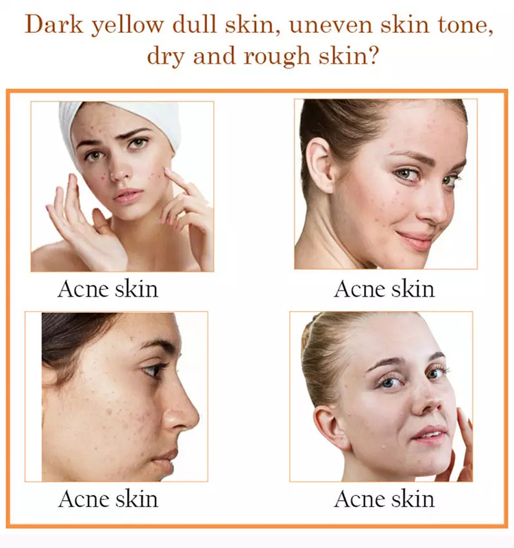 Moisturizing Face Serum 1