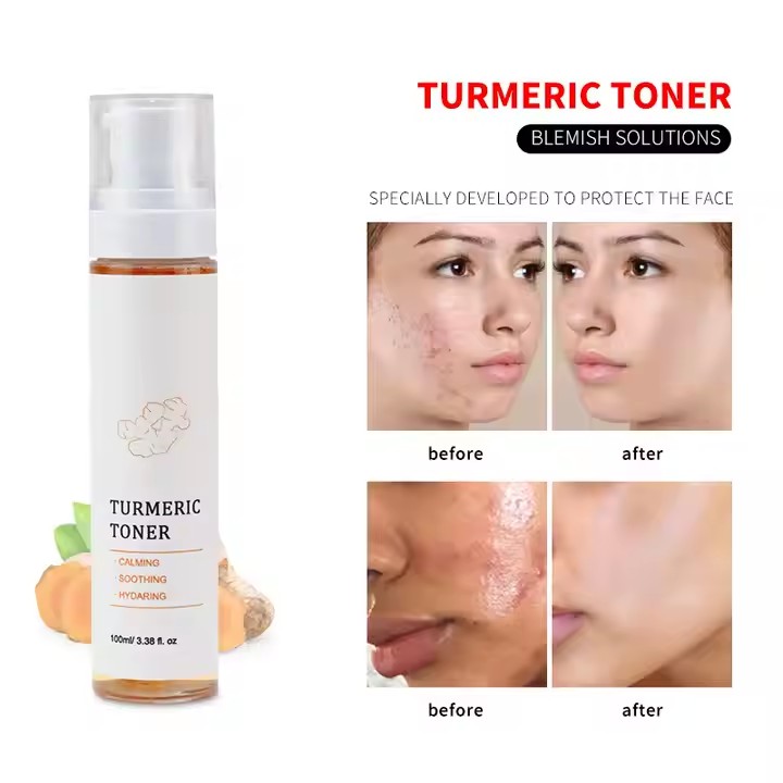 Private Label Skin Care Facial Face Mist Spray Toner Supplier, Odm