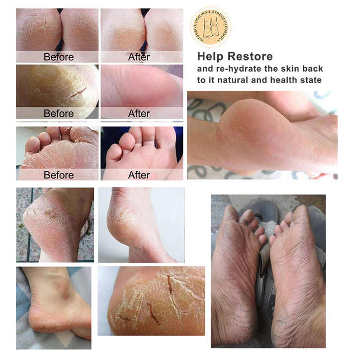 Private Label Softening Foot Cream Heel Balm Manufacturer, Odm