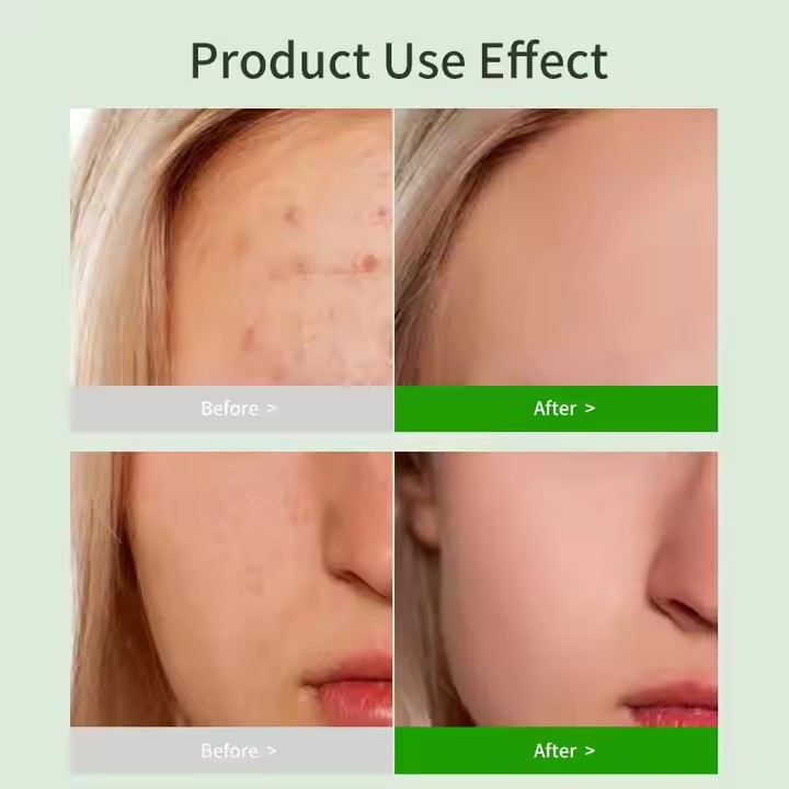 Private Label Whitening Natural Facial Scrubs Supplier, Factory