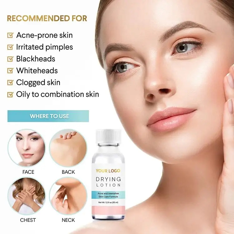 Private Label Acne Creams Acne Treatments Factory, Oem