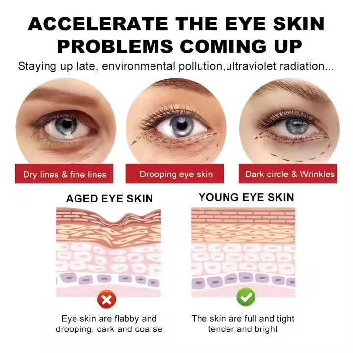Private Label Dark Circles Under Eye Cream Moisturizer Supplier, Factory