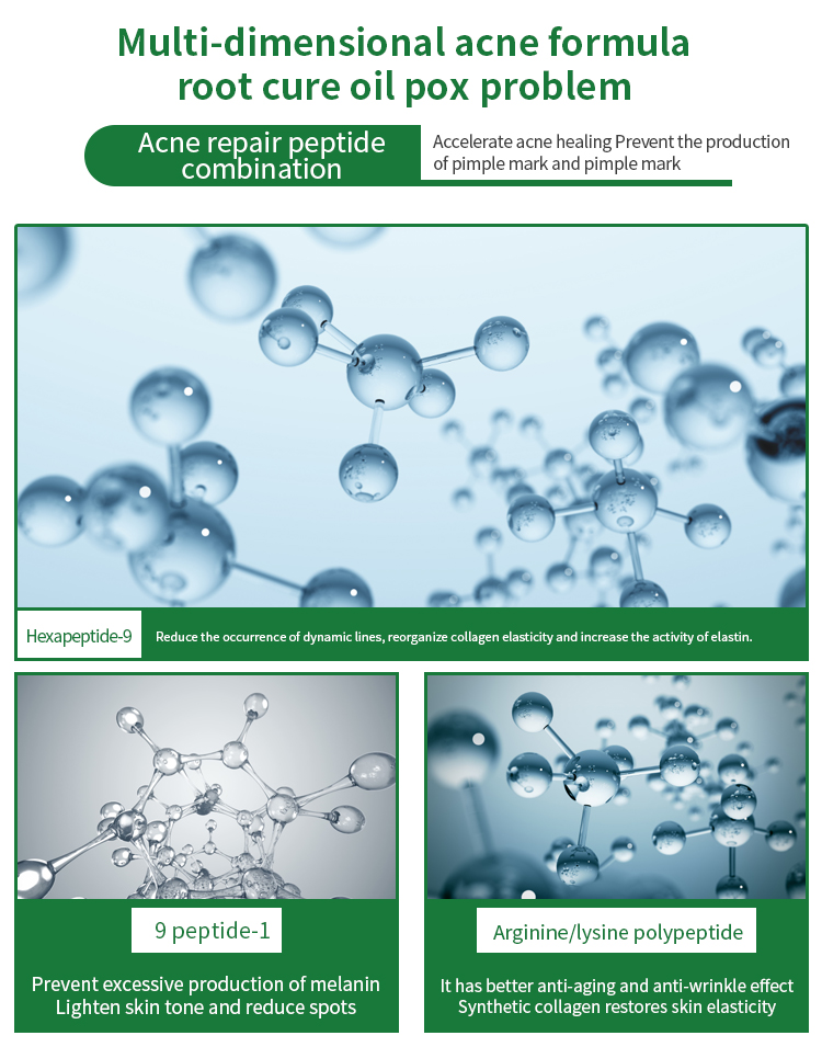Acne Care Formula
