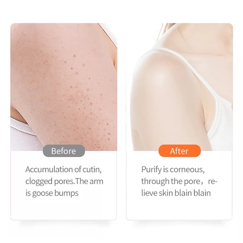 Underarm and Dark Spot Cream