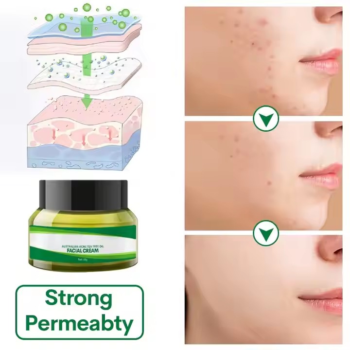Private Label Skin Care Repair Facial Cream Factory, Odm