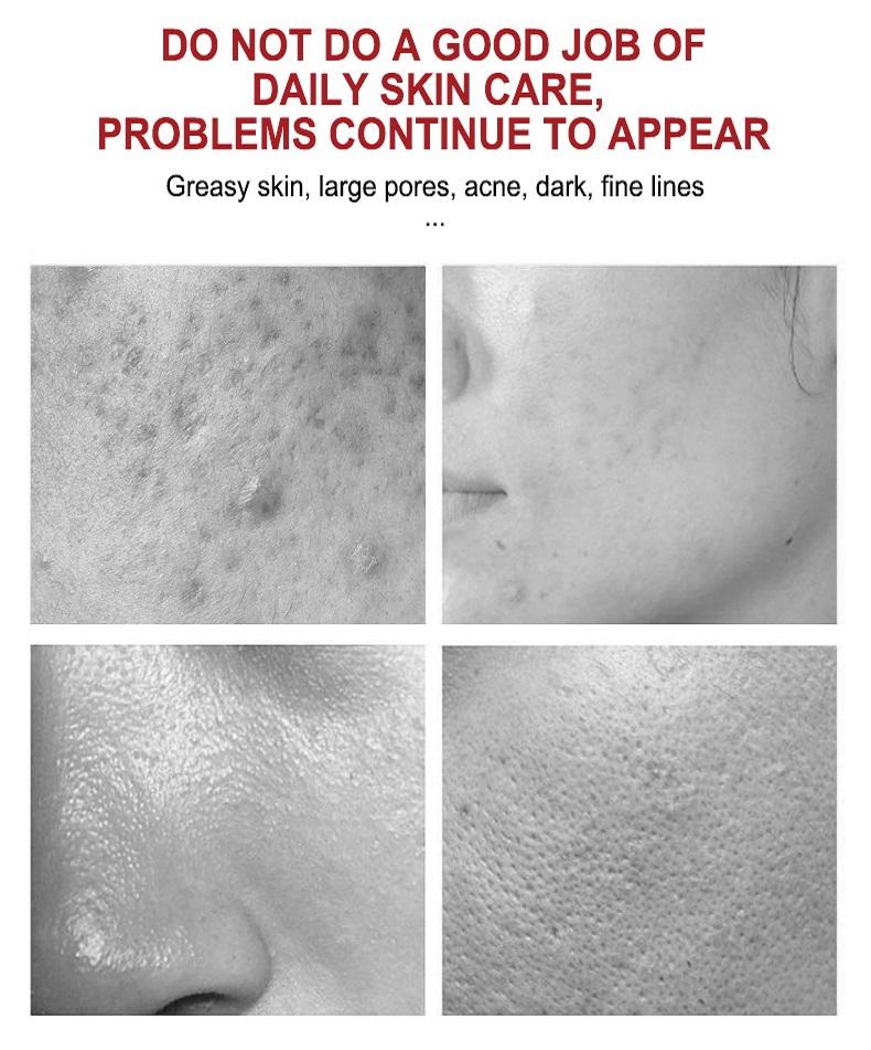 Kojic Acid Face Cream - Skincare Application