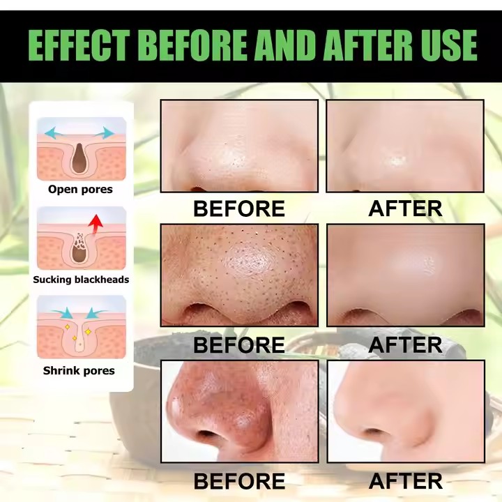 Private Label Beauty Facial Mask Skin Care Manufacturer, Supplier