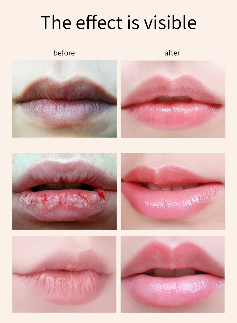 Crystal Lip Mask Details