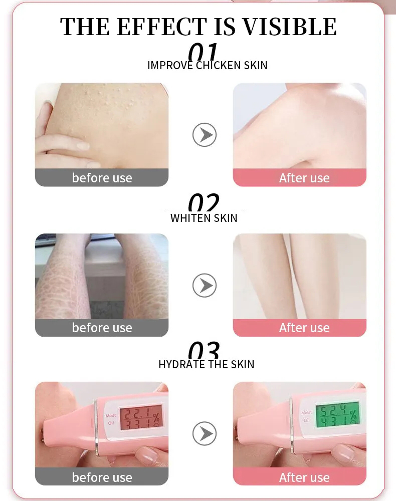 Underarm Whitening Cream