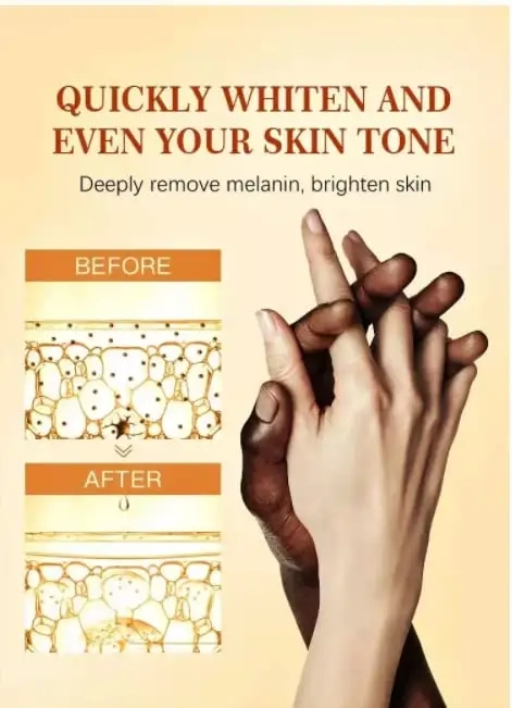 Private Label Dark Knuckle Whitening Serum Oem, Bulk