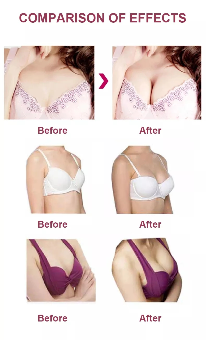Breast Enlargement Cream View 8