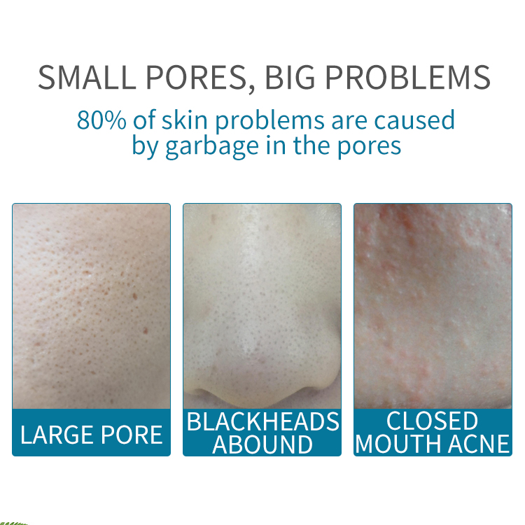 Pore Refinement and Calming