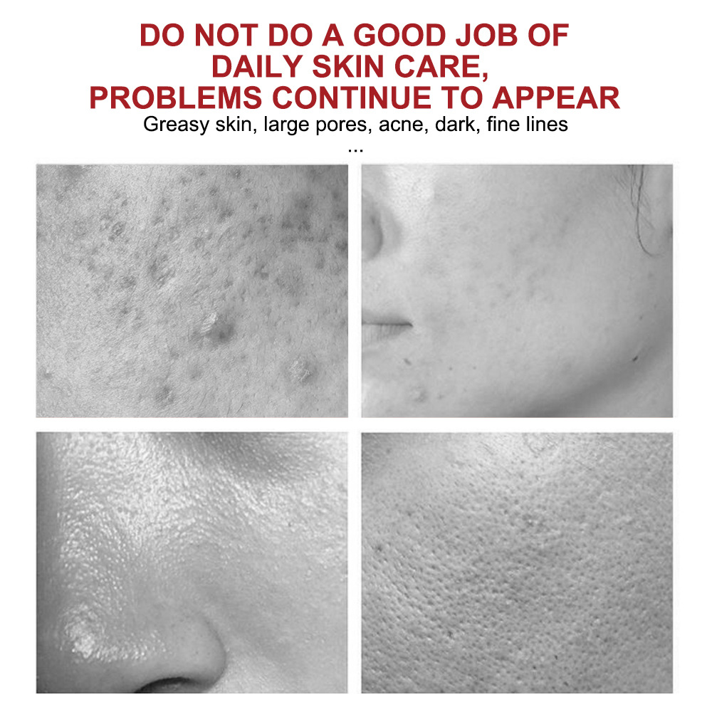 Private Label Kojic Acid Face Cream Oem, Bulk
