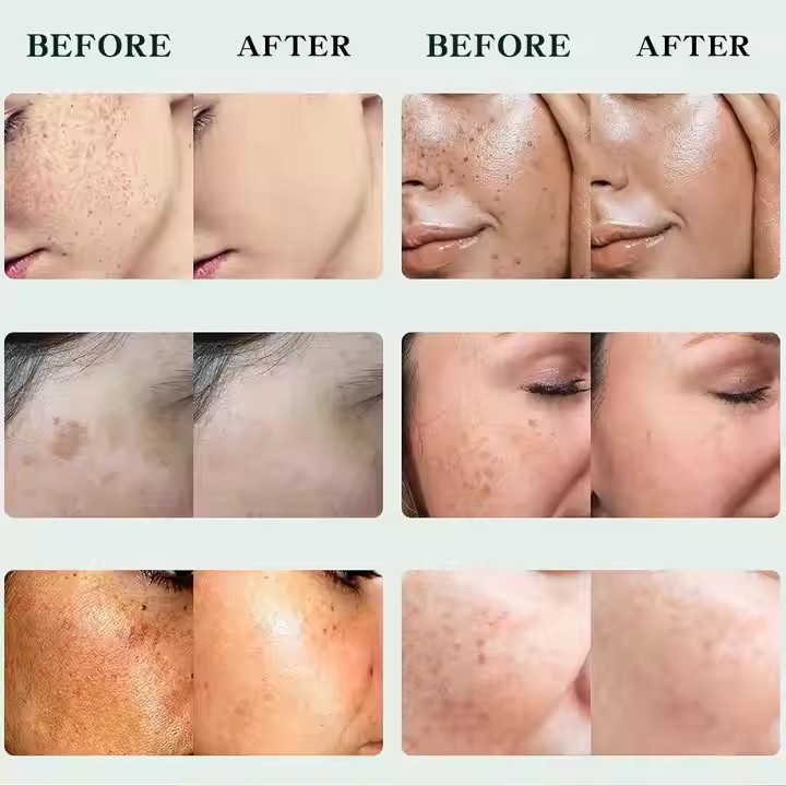 Private Label Vitamin C Whitening Face Skin Care Supplier, Odm