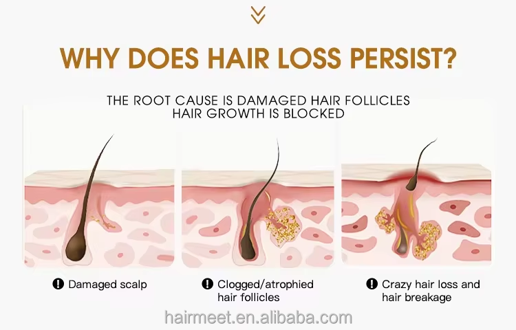 5% Hair Growth Oil Feature 4