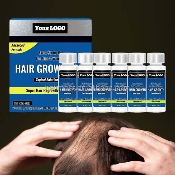 Wholesale Organic Nourishing Herbal Hair Scalp Treatment Oil 5% for Men Women Hair Growth