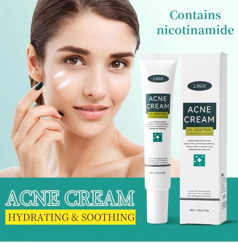 Acne Face Cream 30g Hydrating Anti-Acne Treatment Cream for Blemish Care & Oil Control