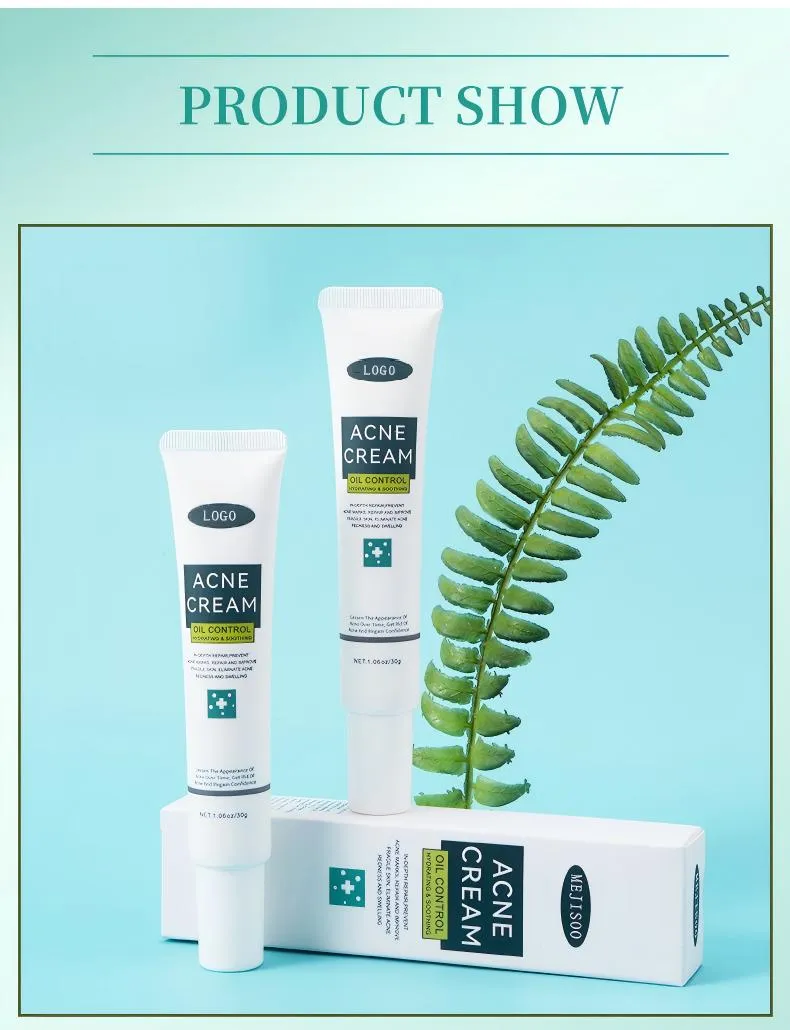 Acne Face Cream 30g Hydrating Anti-Acne Treatment Cream for Blemish Care & Oil Control