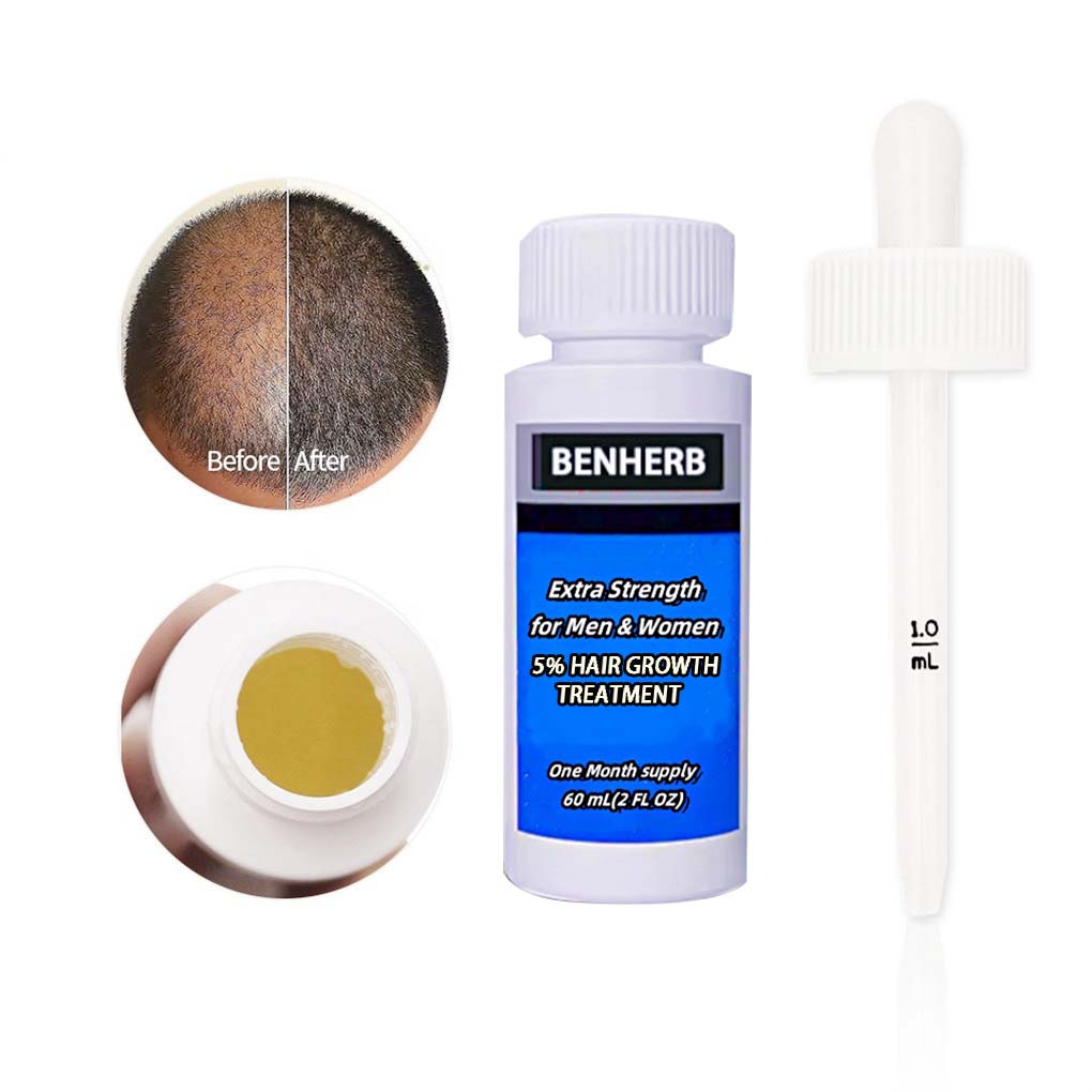 Fast Hair Growth Oil Repair Hair Scalp Care Anti Hair Loss Treatment Herbal Regrowth Thicken Serum Essence for Men Women
