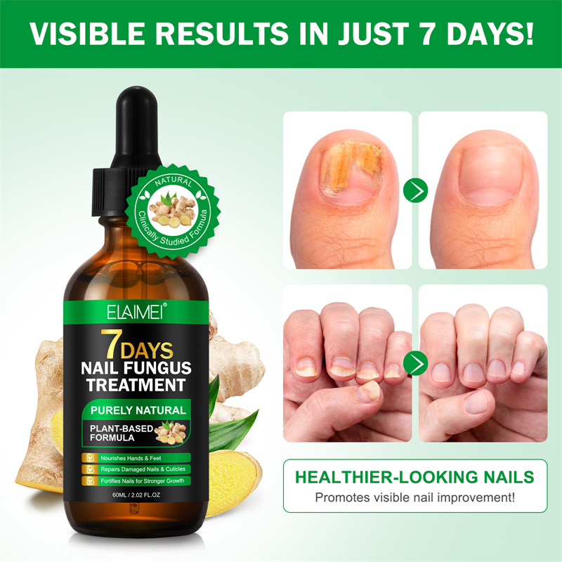 Elaimei 7 Days Nail Fungus Treatment Serum Hands Feet Nourishing Damaged Nails Cuticles Repairing Nails Strengthening Liquid