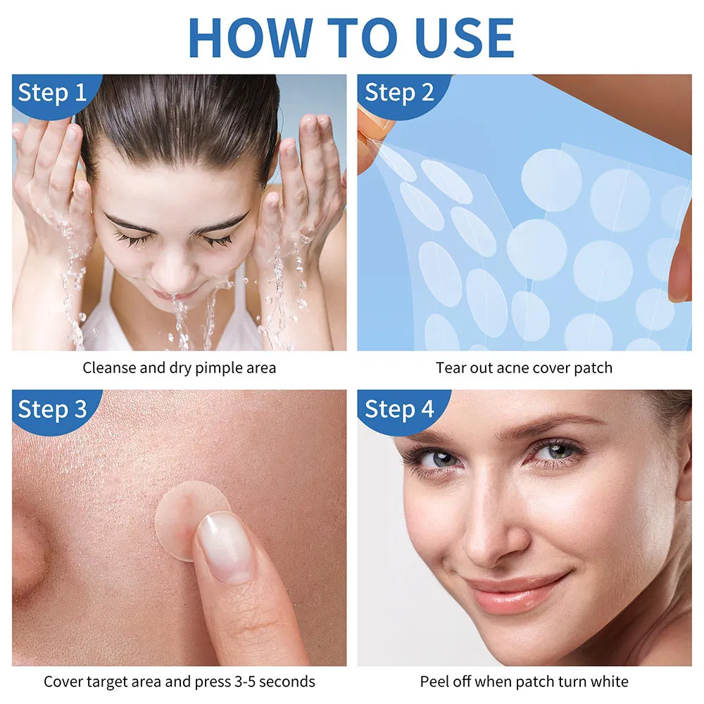 Customized Acne Pimple Treatment with Mirror Hydrocolloid Deep Skin Care Best Sell