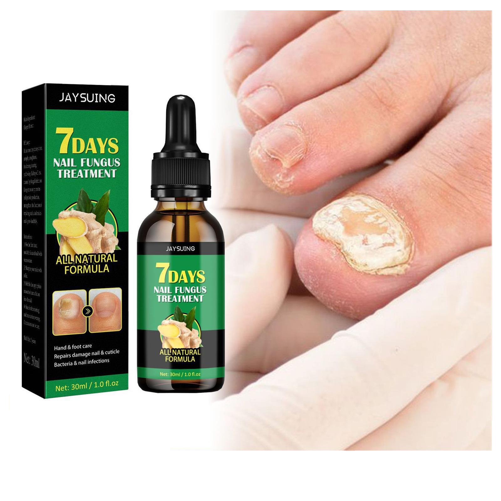 Repair Hand and Foot Nail Care Soft Nail Treast 30ml Brightening and Moisturizing Liquid Damage Nail &amp; Cuticle