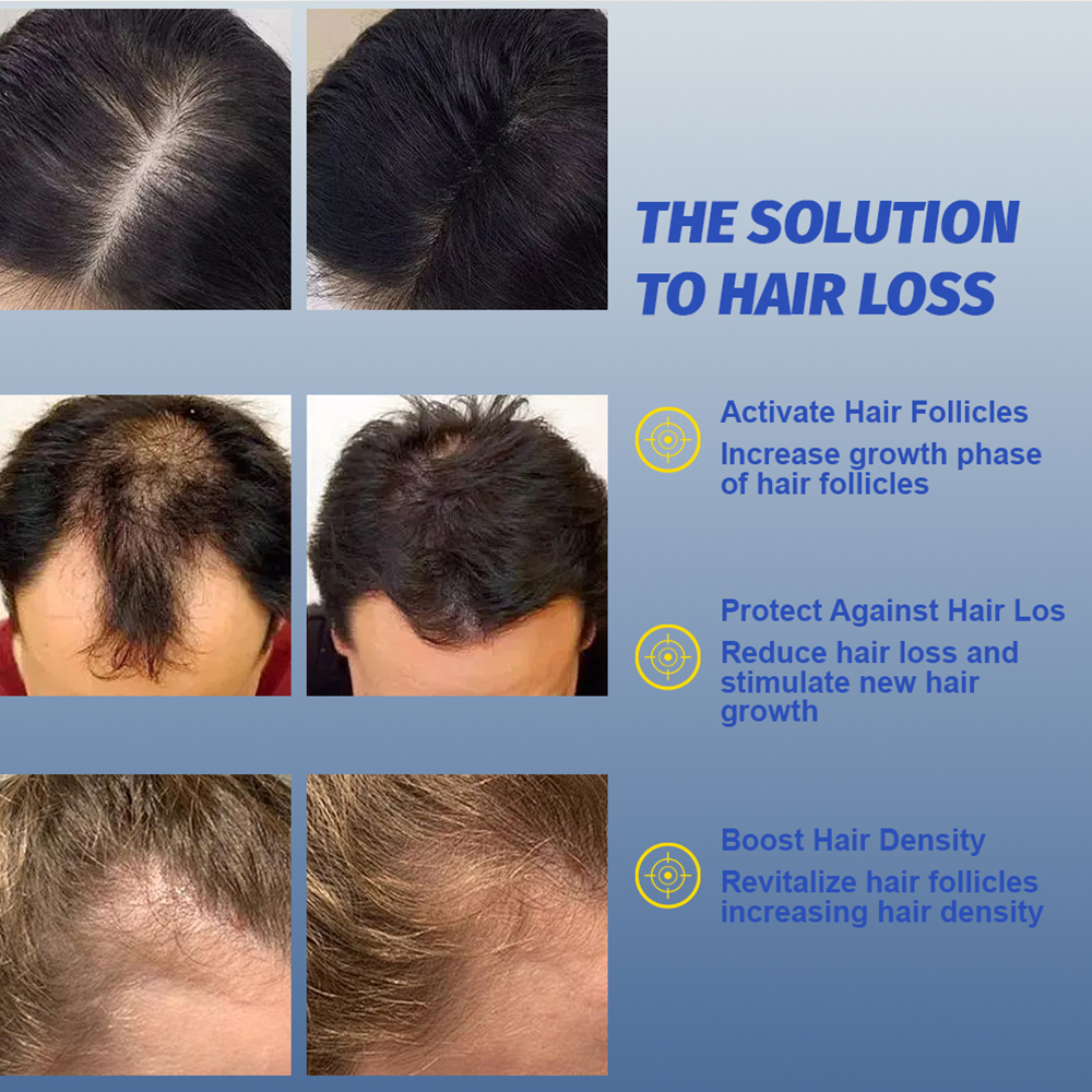 OEM Blue Copper Peptide Hair Growth Serum GHK-Cu AHK-Cu Biotin Hair Growth Treatment Serum for Hair Loss Scalp Nourishing