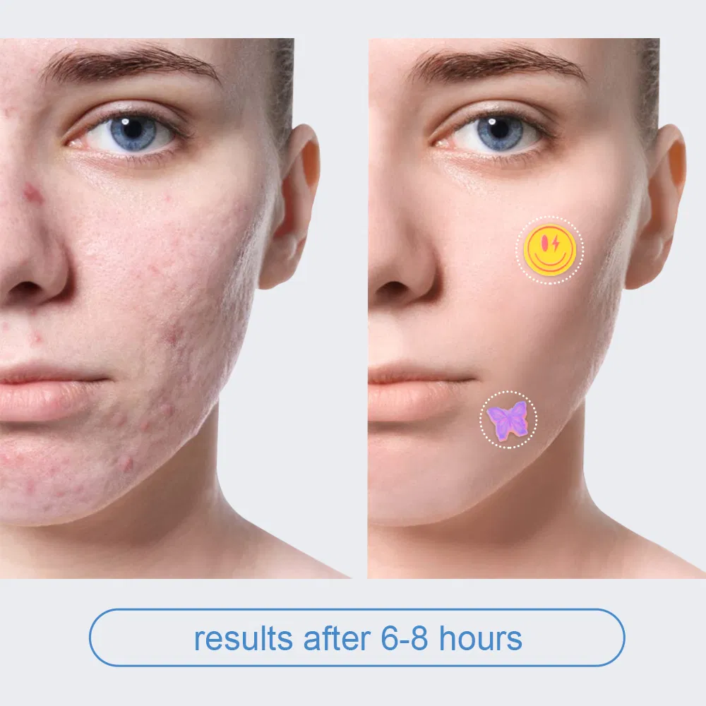 Acne Patch View 6