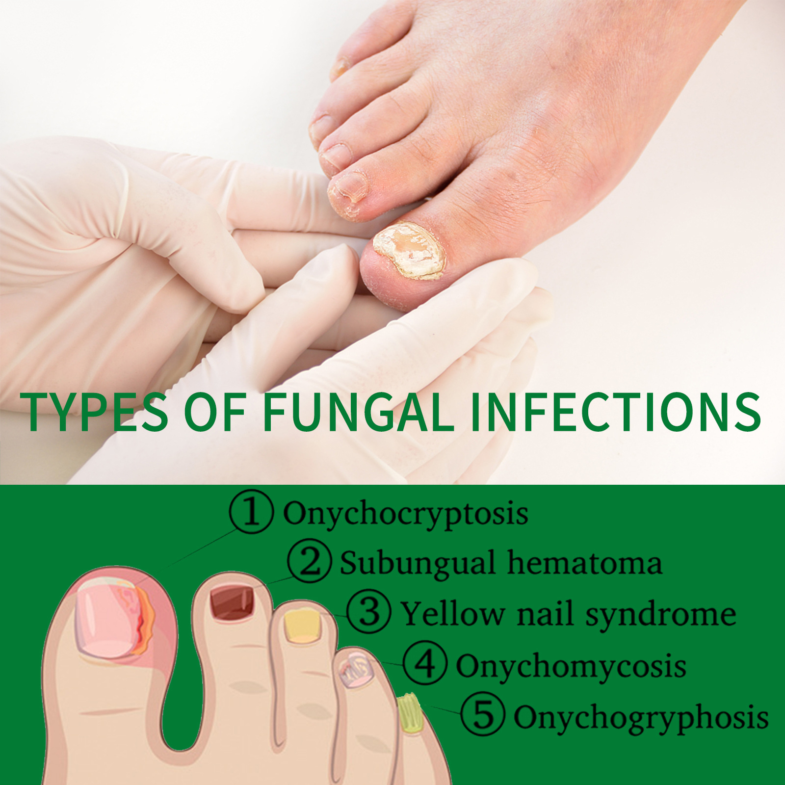 Ginger Nail Care Solution - Soft and Bright Nails, Anti-Fungal Treatment for Hands and Feet