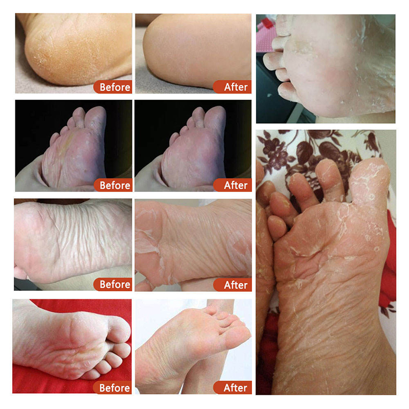 Wholesale 40g Foot Care Prevents Dryness Soften Cutin Lavender & VC Exfoliating Foot Peel Mask