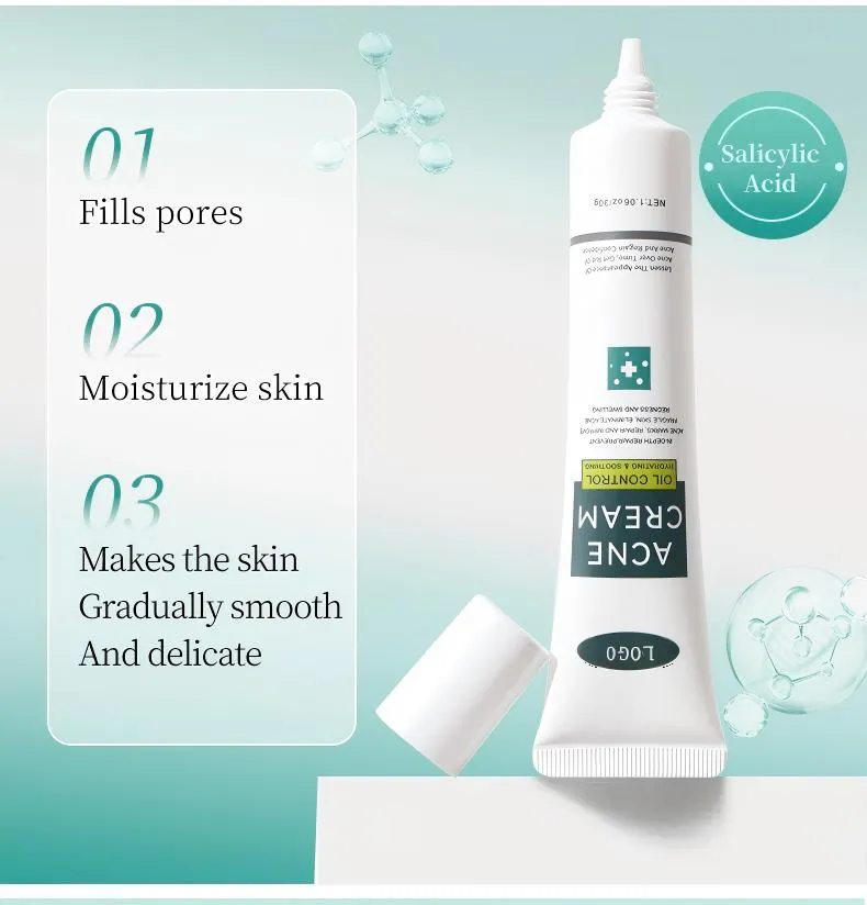 Acne Face Cream 30g Hydrating Anti-Acne Treatment Cream for Blemish Care & Oil Control