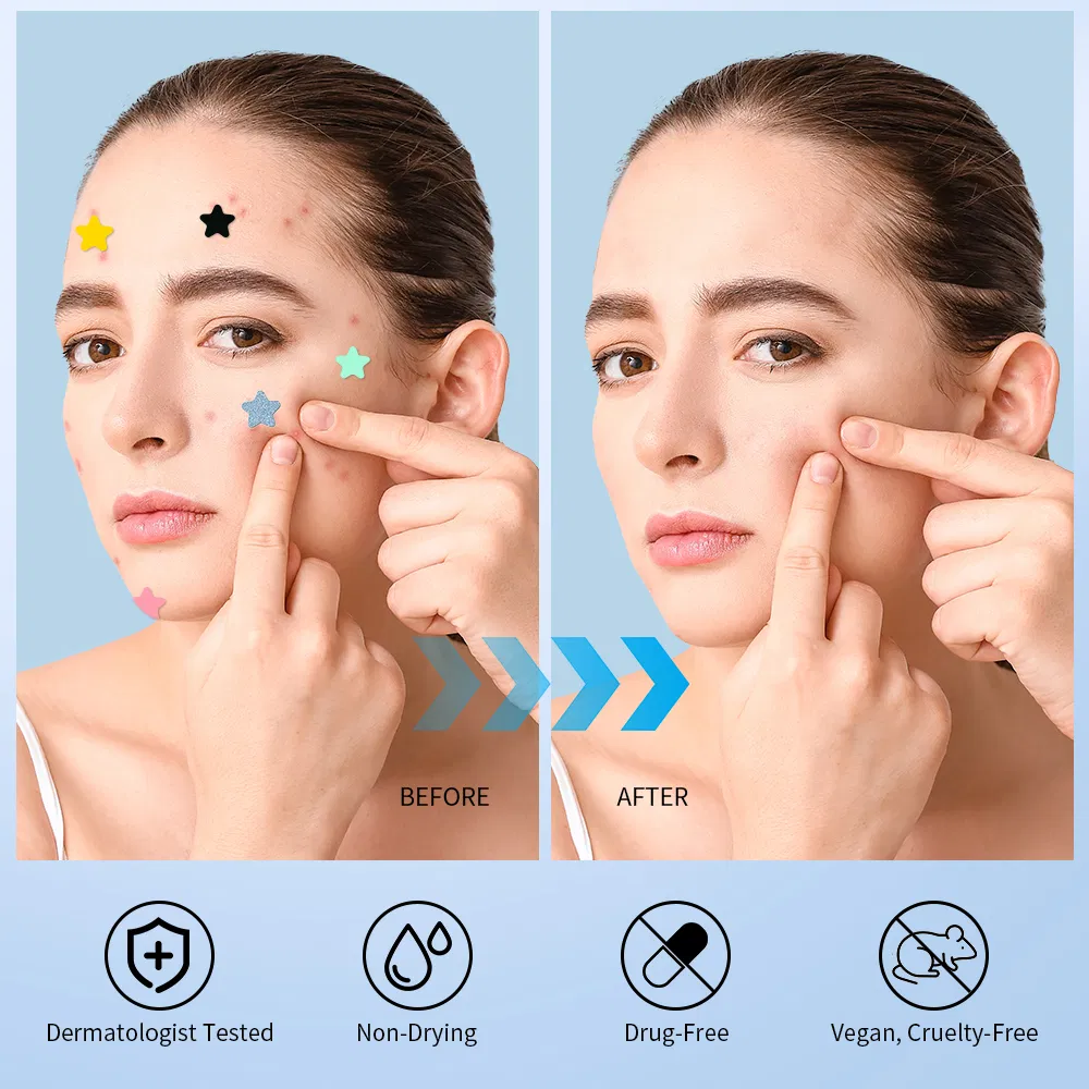 Acne Patches Custom Hydrocolloid Spot Treatment 6