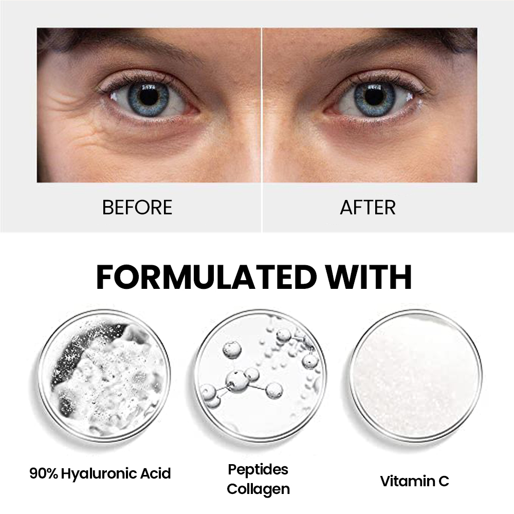 Oem Private Label Collagen Microneedle Eye Mask Eye Patches Anti Wrinkle Hyaluronic Acid Under Eye Microneedle Patch