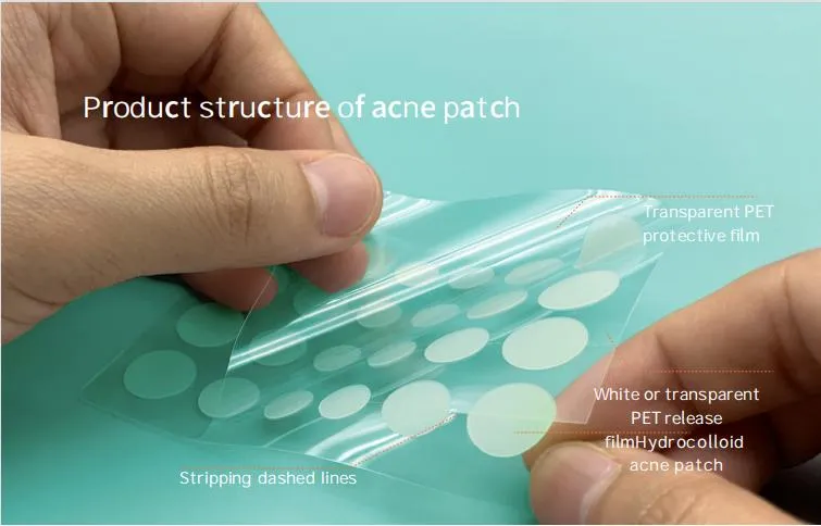 High Quality Hydrocolloid Pimple Patch: Miracle Acne Spot Treatment Sale