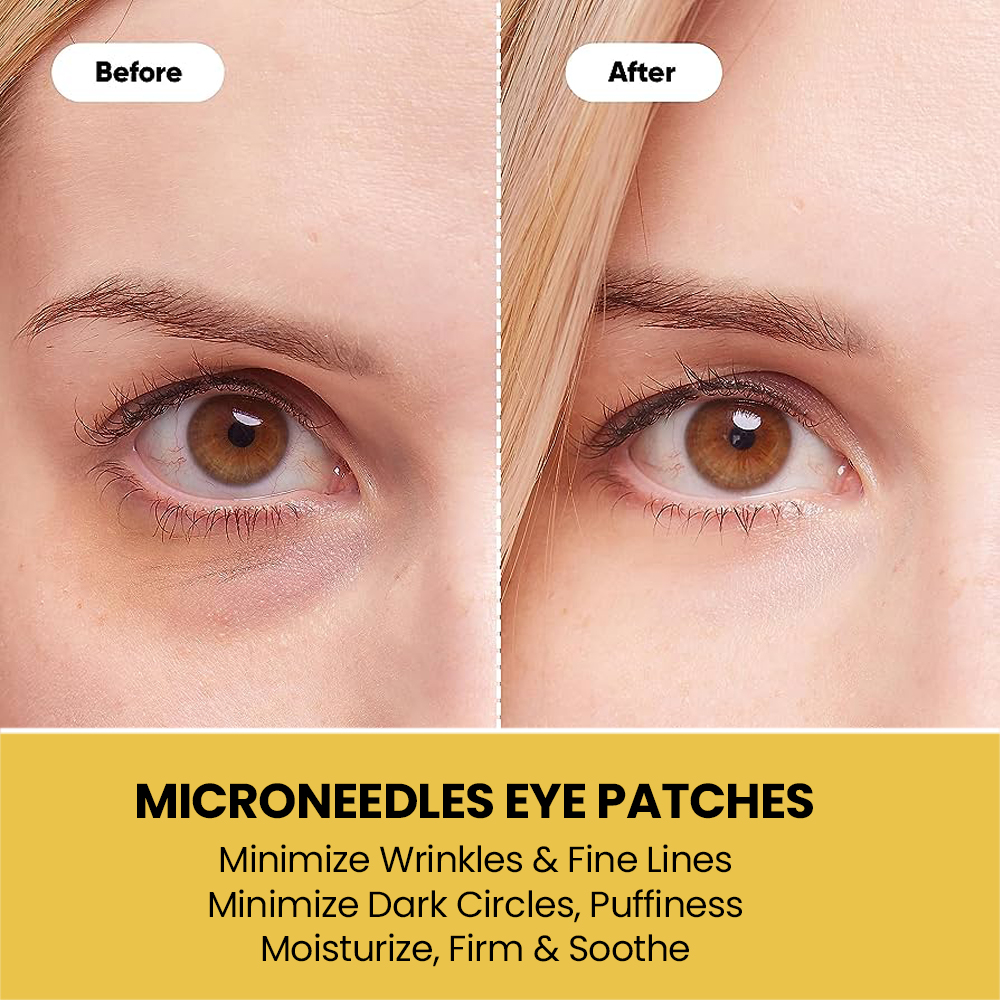Oem Private Label Collagen Microneedle Eye Mask Eye Patches Anti Wrinkle Hyaluronic Acid Under Eye Microneedle Patch