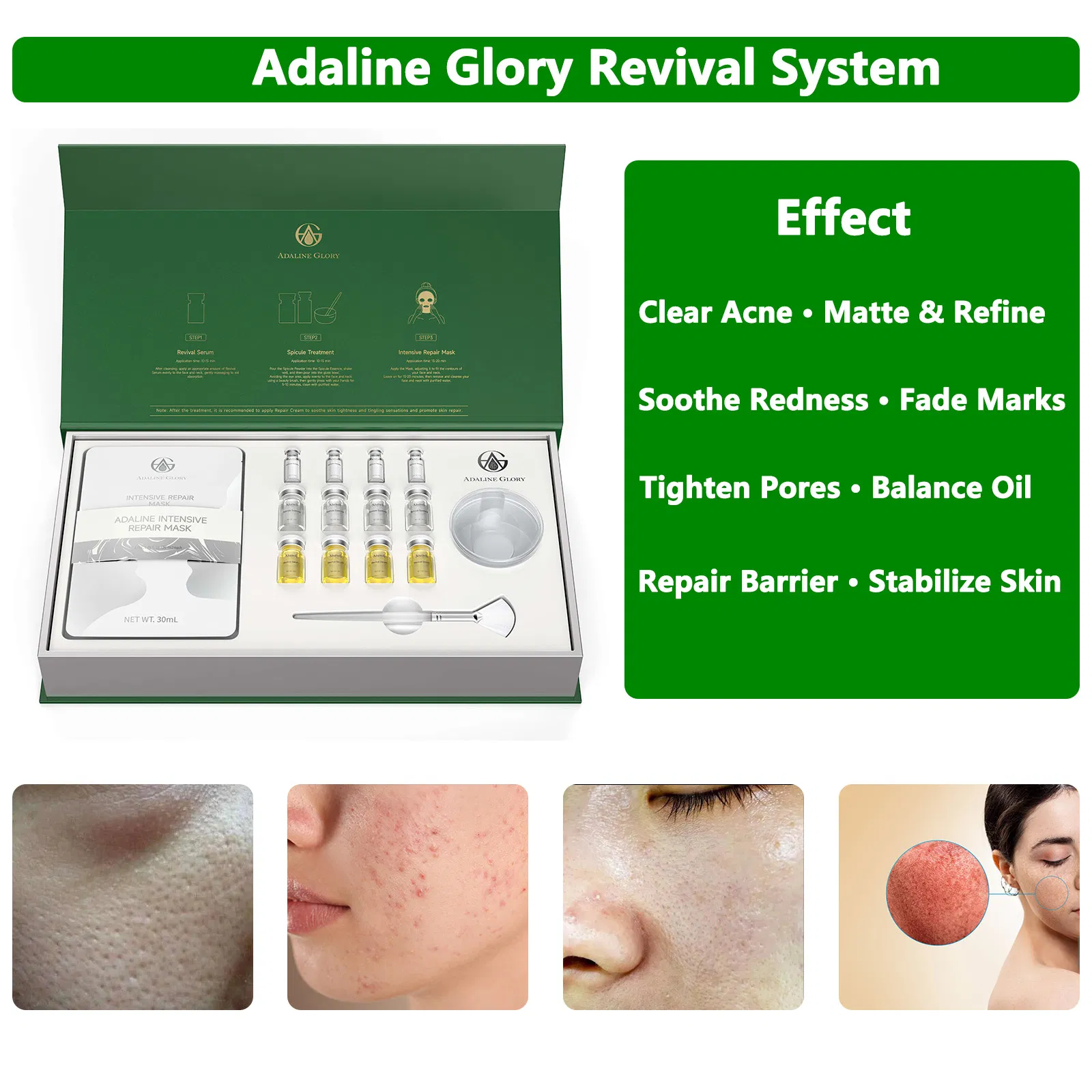 Adaline Glory Revival System Expert Melasma Solution: Spongilla Facial Treatment for Skin Renewal