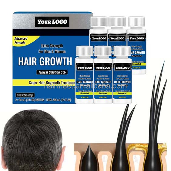Wholesale Organic Nourishing Herbal Hair Scalp Treatment Oil 5% for Men Women Hair Growth