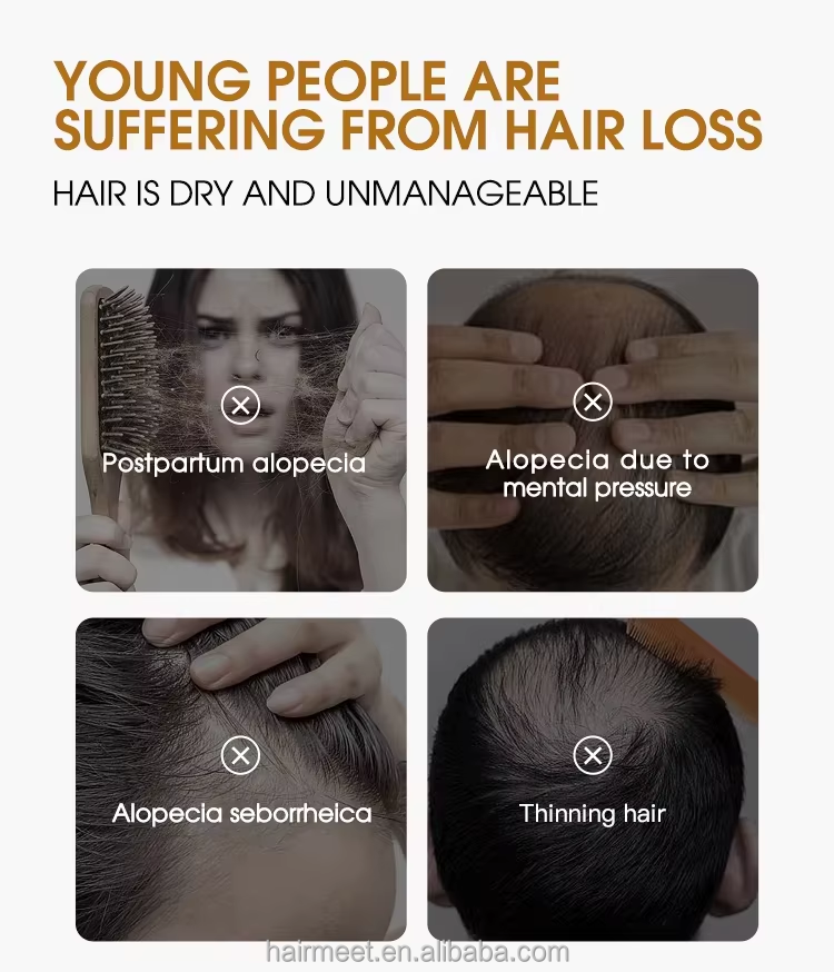 5% Hair Growth Oil Feature 5