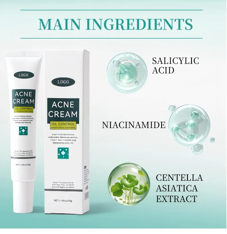 Acne Face Cream 30g Hydrating Anti-Acne Treatment Cream for Blemish Care & Oil Control